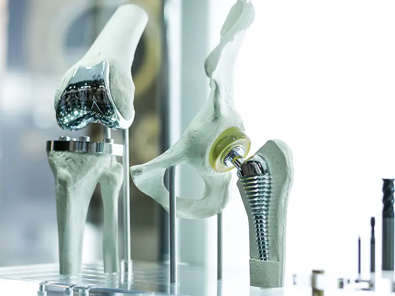 medical implants manufacturing